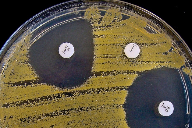 Человеческий организм учит патогенные бактерии терпимости к лекарствам